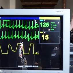 Elise Graves en 'Kink Partners' Envasado al vacío (Miniatura 1)